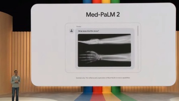 Google тестирует чат-бота Med-PaLM 2 в клиниках - он помогает врачам