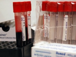Минздрав назвал европейские клиники, где украинцы с ВИЧ могут получить антиретровирусную терапию