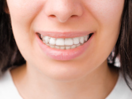 Яка ціна на елайнери та їх переваги у вирівнюванні зубів