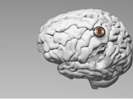 Первый пациент Neuralink научился управлять курсором мыши силой мысли